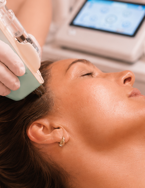 Skin Revive Scalp – zabieg na skórę głowy